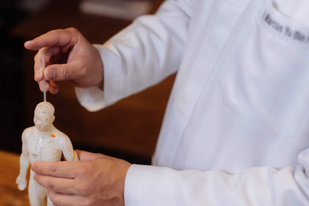 Mão segura uma agulha de acupuntura sobre um modelo anatômico com os pontos marcados.